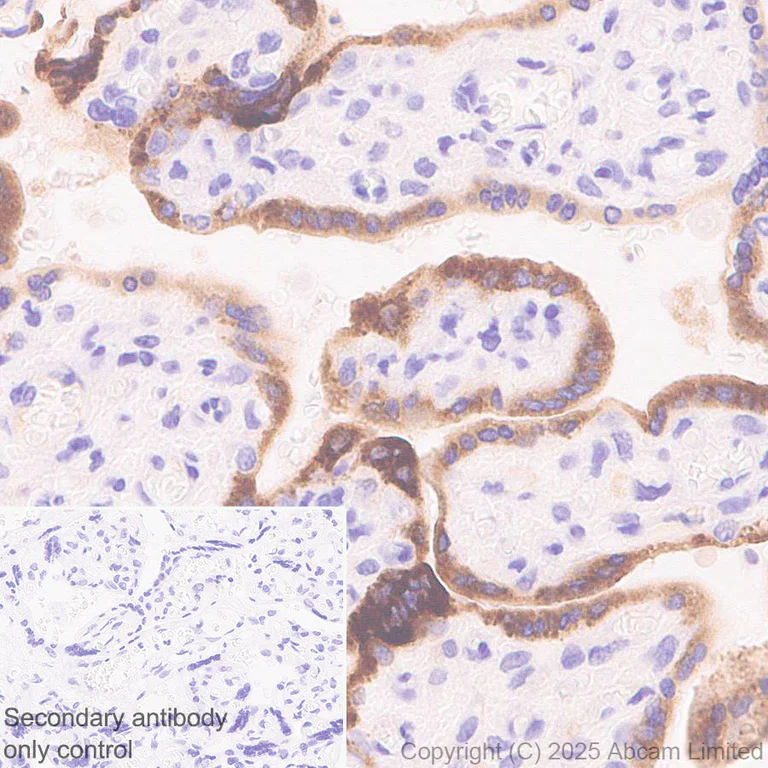 Immunohistochemistry (Formalin/PFA-fixed paraffin-embedded sections) - Anti-hCG beta (pan CGB) antibody [EPR29783-529] (AB324382)