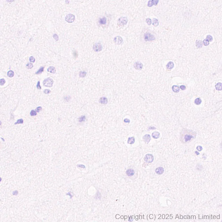 Immunohistochemistry (Formalin/PFA-fixed paraffin-embedded sections) - Anti-hCG beta (pan CGB) antibody [EPR29783-529] (AB324382)
