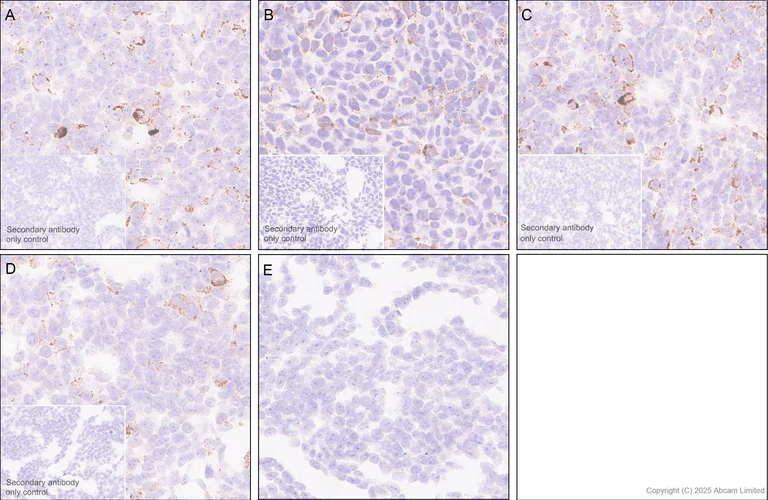 Immunohistochemistry (Formalin/PFA-fixed paraffin-embedded sections) - Anti-hCG beta (pan CGB) antibody [EPR29783-529] (AB324382)