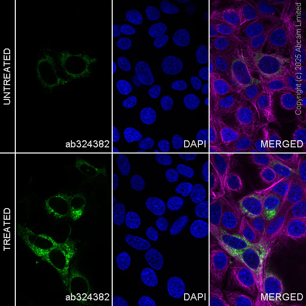 Immunocytochemistry/ Immunofluorescence - Anti-hCG beta (pan CGB) antibody [EPR29783-529] - BSA and Azide free (AB324388)