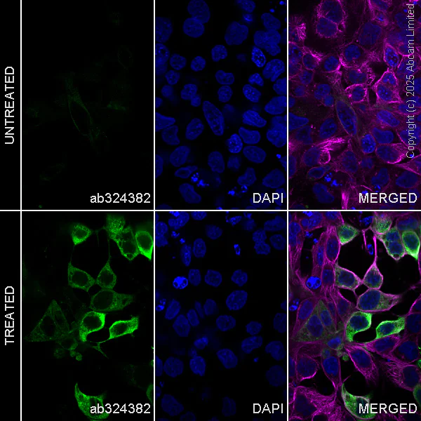 Immunocytochemistry/ Immunofluorescence - Anti-hCG beta (pan CGB) antibody [EPR29783-529] - BSA and Azide free (AB324388)