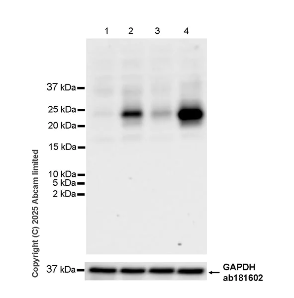 Western blot - Anti-hCG beta (pan CGB) antibody [EPR29783-529] - BSA and Azide free (AB324388)