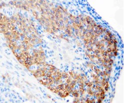 Immunohistochemistry (Formalin/PFA-fixed paraffin-embedded sections) - Anti-hCG receptor/LHR antibody (AB125214)