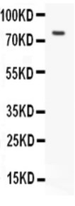 Western blot - Anti-hCG receptor/LHR antibody (AB125214), expandable thumbnail