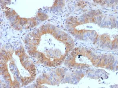 Immunohistochemistry (Formalin/PFA-fixed paraffin-embedded sections) - Anti-hCG receptor/LHR antibody [LHCGR/1417] - BSA and Azide free (AB218907)