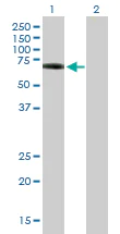 Western blot - Anti-Hck antibody (AB171905)
