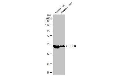 Western blot - Anti-HCK antibody [HL1673] (AB308234), expandable thumbnail