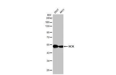 Western blot - Anti-HCK antibody [HL1673] (AB308234), expandable thumbnail