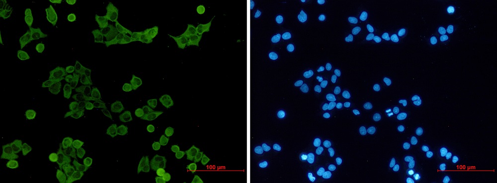 Immunocytochemistry/ Immunofluorescence - Anti-Hck Antibody [S02-5C1] (AB317426)
