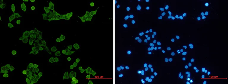 Immunocytochemistry/ Immunofluorescence - Anti-Hck Antibody [S02-5C1] (AB317426)