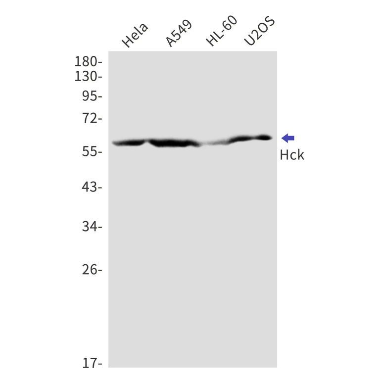 Western blot - Anti-Hck Antibody [S02-5C1] (AB317426)