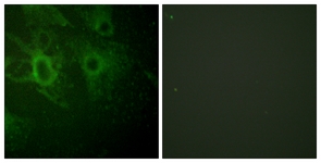 Immunocytochemistry/ Immunofluorescence - Anti-Hck (phospho Y410) antibody (AB61055)