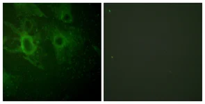 Immunocytochemistry/ Immunofluorescence - Anti-Hck (phospho Y410) antibody (AB61055)