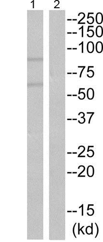 Western blot - Anti-Hck (phospho Y522) antibody (AB192578)