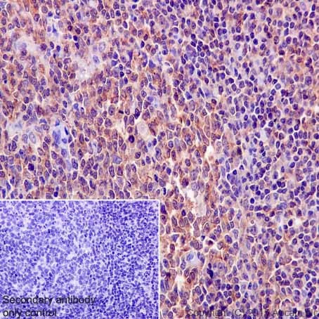 Immunohistochemistry (Formalin/PFA-fixed paraffin-embedded sections) - Anti-HCLS1 antibody [EPR16540] - BSA and Azide free (AB251388)