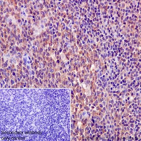 Immunohistochemistry (Formalin/PFA-fixed paraffin-embedded sections) - Anti-HCLS1 antibody [EPR16540] - BSA and Azide free (AB251388)