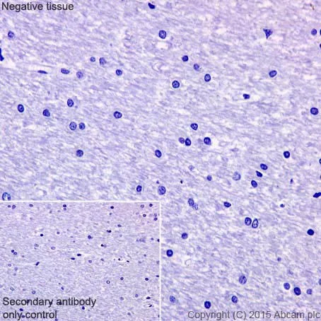 Immunohistochemistry (Formalin/PFA-fixed paraffin-embedded sections) - Anti-HCLS1 antibody [EPR16540] - BSA and Azide free (AB251388)