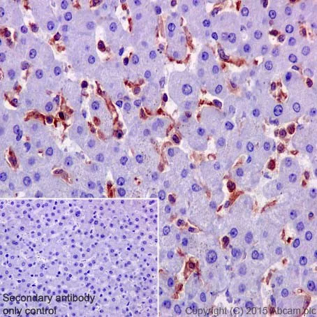 Immunohistochemistry (Formalin/PFA-fixed paraffin-embedded sections) - Anti-HCLS1 antibody [EPR16540] - BSA and Azide free (AB251388)