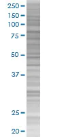 SDS-PAGE - HCLS1 overexpression 293T lysate (whole cell) (AB94153)