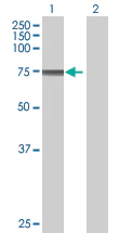 Western blot - HCLS1 overexpression 293T lysate (whole cell) (AB94153)