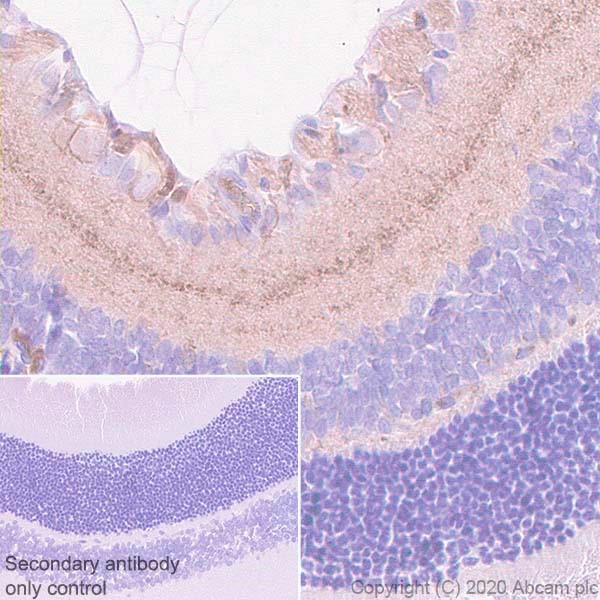 Immunohistochemistry (Formalin/PFA-fixed paraffin-embedded sections) - Anti-HCN1 antibody [7C3] (AB252835), expandable thumbnail