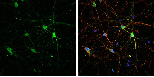 Immunocytochemistry/ Immunofluorescence - Anti-HCN1 antibody - C-terminal (AB229340)