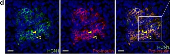 Immunohistochemistry - Anti-HCN1 antibody [S70] (AB84816)