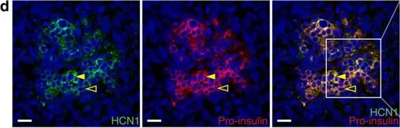 Immunohistochemistry - Anti-HCN1 antibody [S70] (AB84816)