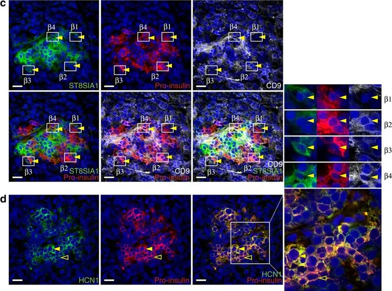 Immunohistochemistry - Anti-HCN1 antibody [S70] (AB84816)