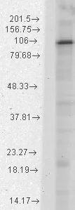Western blot - Anti-HCN1 antibody [S70] (AB84816)