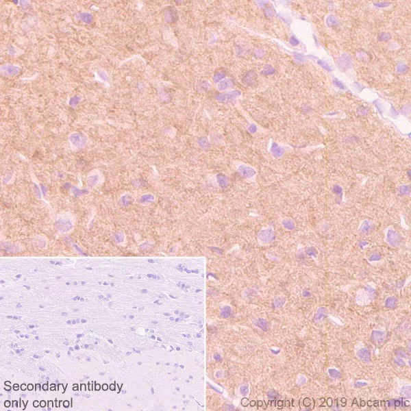Immunohistochemistry (Formalin/PFA-fixed paraffin-embedded sections) - Anti-HCN2 antibody [4A6] (AB252836)