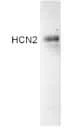 Western blot - Anti-HCN2 antibody (AB19346)