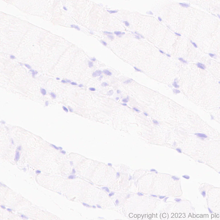 Immunohistochemistry (Formalin/PFA-fixed paraffin-embedded sections) - Anti-HCN2 antibody [EPR26389-129] (AB313873)