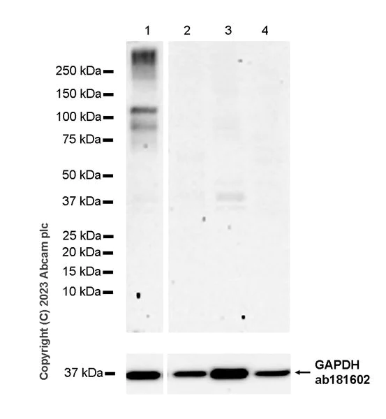 Western blot - Anti-HCN2 antibody [EPR26389-129] (AB313873)