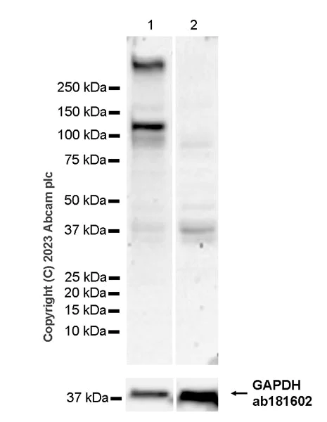 Western blot - Anti-HCN2 antibody [EPR26389-129] (AB313873)