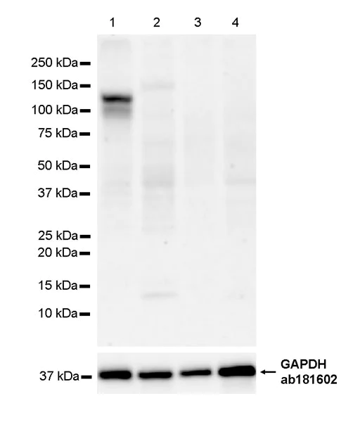 Western blot - Anti-HCN2 antibody [EPR26389-129] - BSA and Azide free (AB313874)