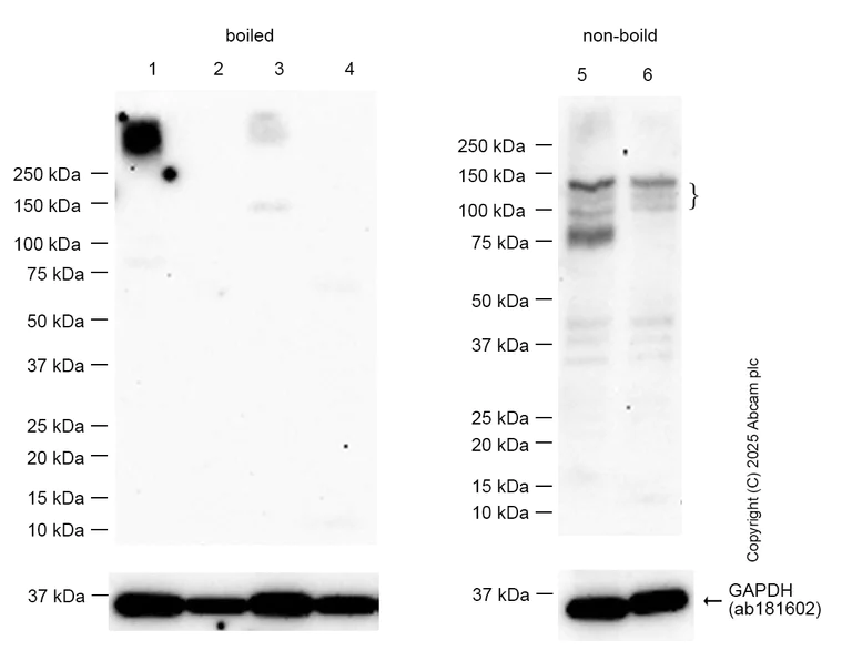 Western blot - Anti-HCN2 antibody [EPR26389-129] - BSA and Azide free (AB313874)