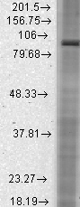 Western blot - Anti-HCN2 antibody [S71] (AB84817), expandable thumbnail