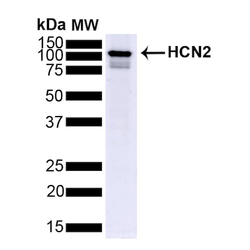 Western blot - Anti-HCN2 antibody [S71] (AB84817), expandable thumbnail
