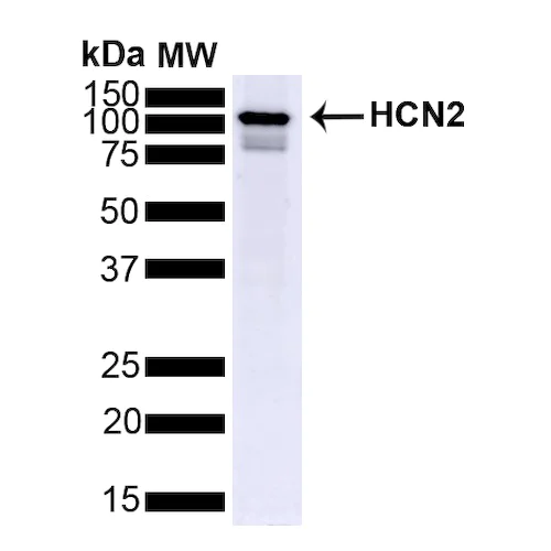 Western blot - Anti-HCN2 antibody [S71] (AB84817)