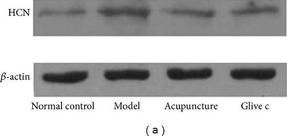 Western blot - Anti-HCN2 antibody [S71] (AB84817)