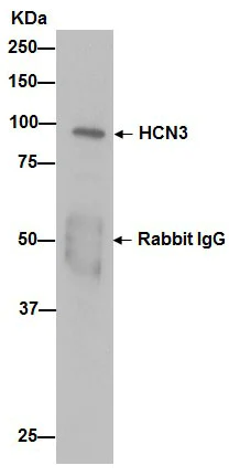 Immunoprecipitation - Anti-HCN3 antibody [EPR13494(2)] (AB192025)