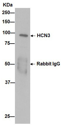 Immunoprecipitation - Anti-HCN3 antibody [EPR13494(2)] - BSA and Azide free (AB251107), expandable thumbnail