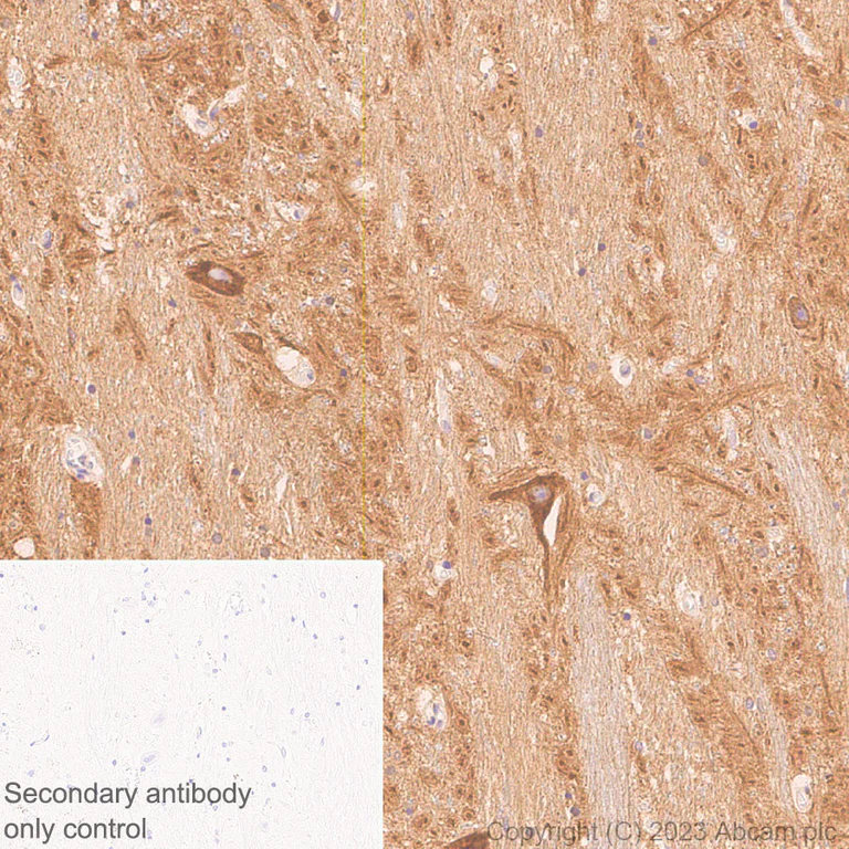 Immunohistochemistry (Formalin/PFA-fixed paraffin-embedded sections) - Anti-HCN3 antibody [EPR27844-43] (AB313791)