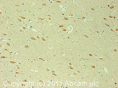 Immunohistochemistry (Formalin/PFA-fixed paraffin-embedded sections) - Anti-HCN4 antibody (AB66501)