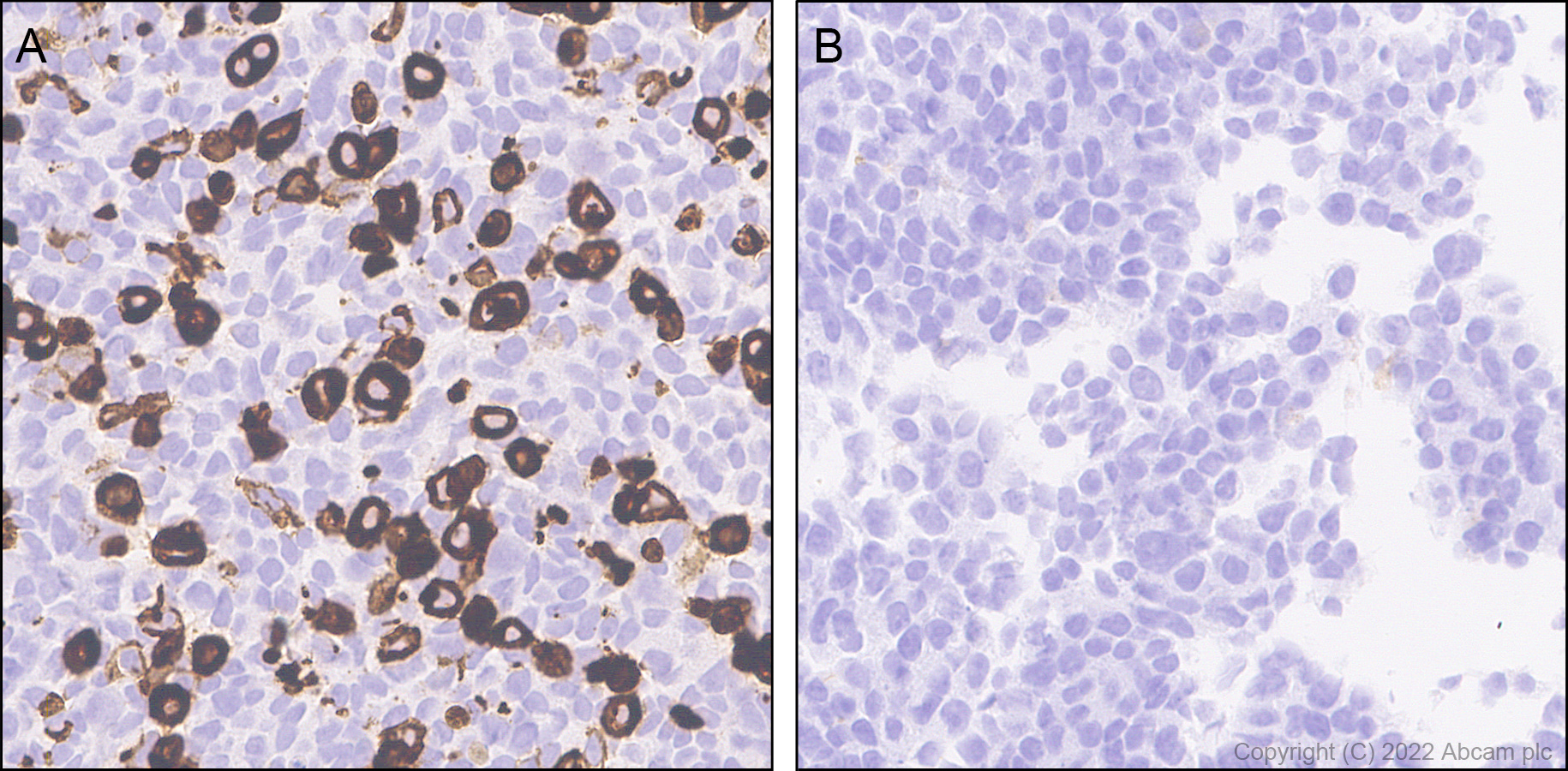 Immunohistochemistry (Formalin/PFA-fixed paraffin-embedded sections) - Anti-HCN4 antibody [EPR25291-44] (AB289962)