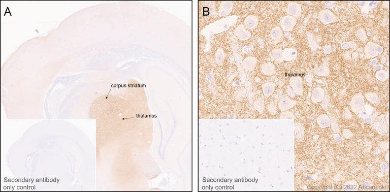 Immunohistochemistry (Formalin/PFA-fixed paraffin-embedded sections) - Anti-HCN4 antibody [EPR25291-44] (AB289962)