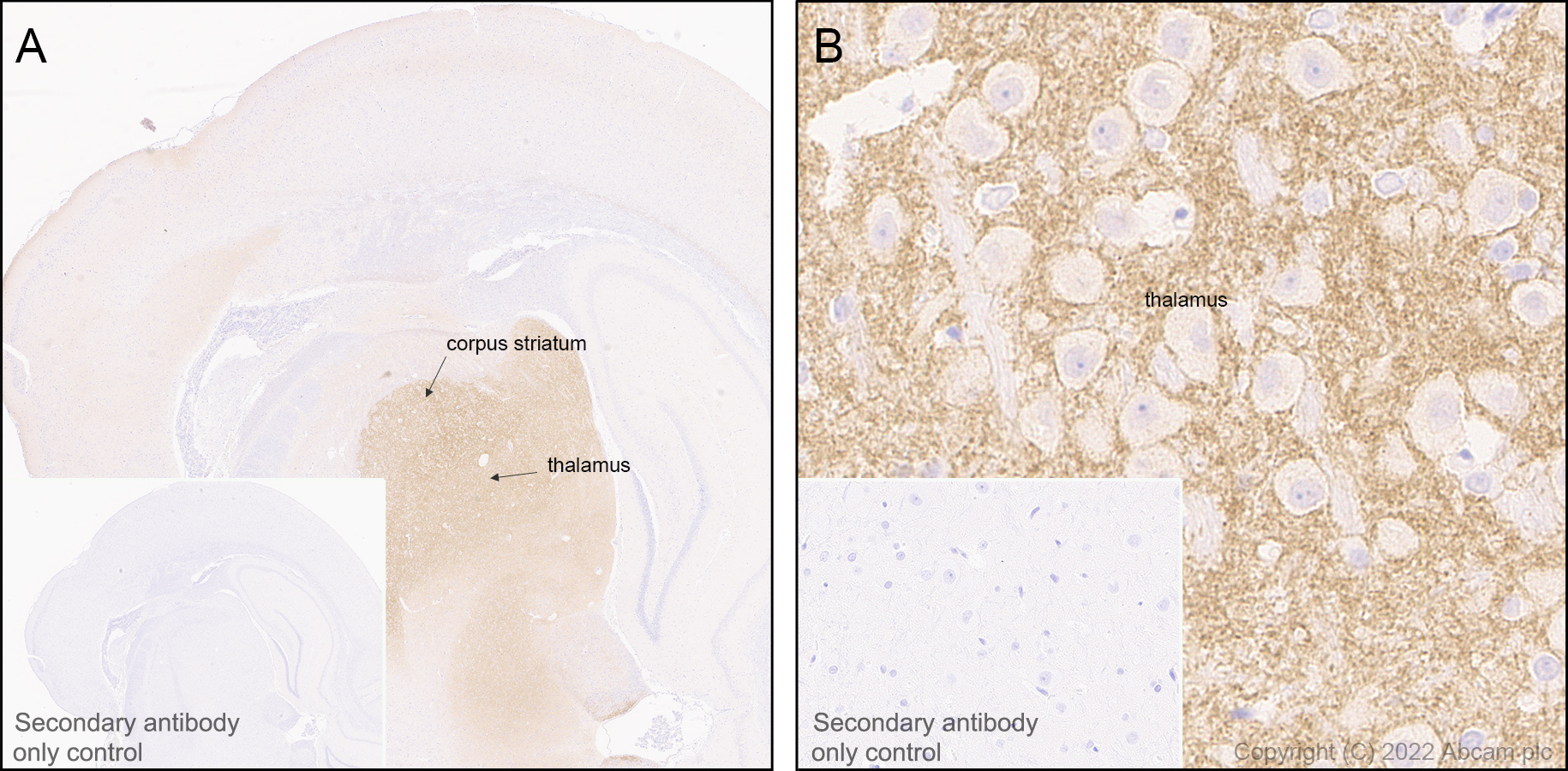 Immunohistochemistry (Formalin/PFA-fixed paraffin-embedded sections) - Anti-HCN4 antibody [EPR25291-44] - BSA and Azide free (AB289985), expandable thumbnail