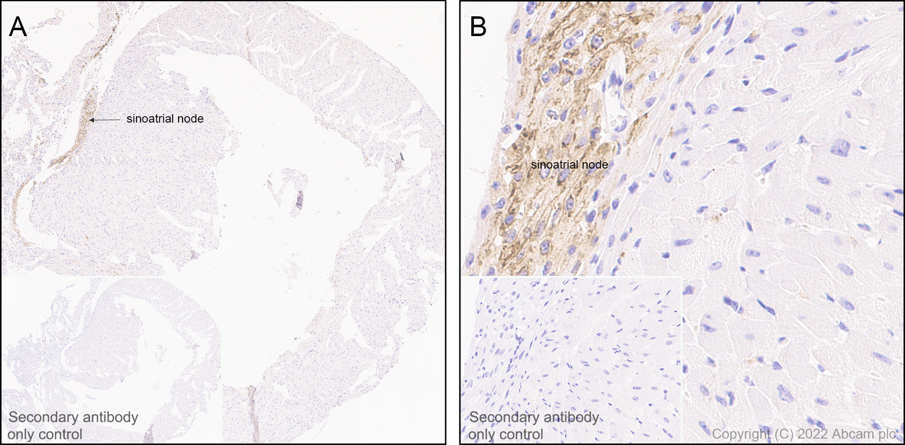 Immunohistochemistry (Formalin/PFA-fixed paraffin-embedded sections) - Anti-HCN4 antibody [EPR25291-44] - BSA and Azide free (ab289985), expandable thumbnail