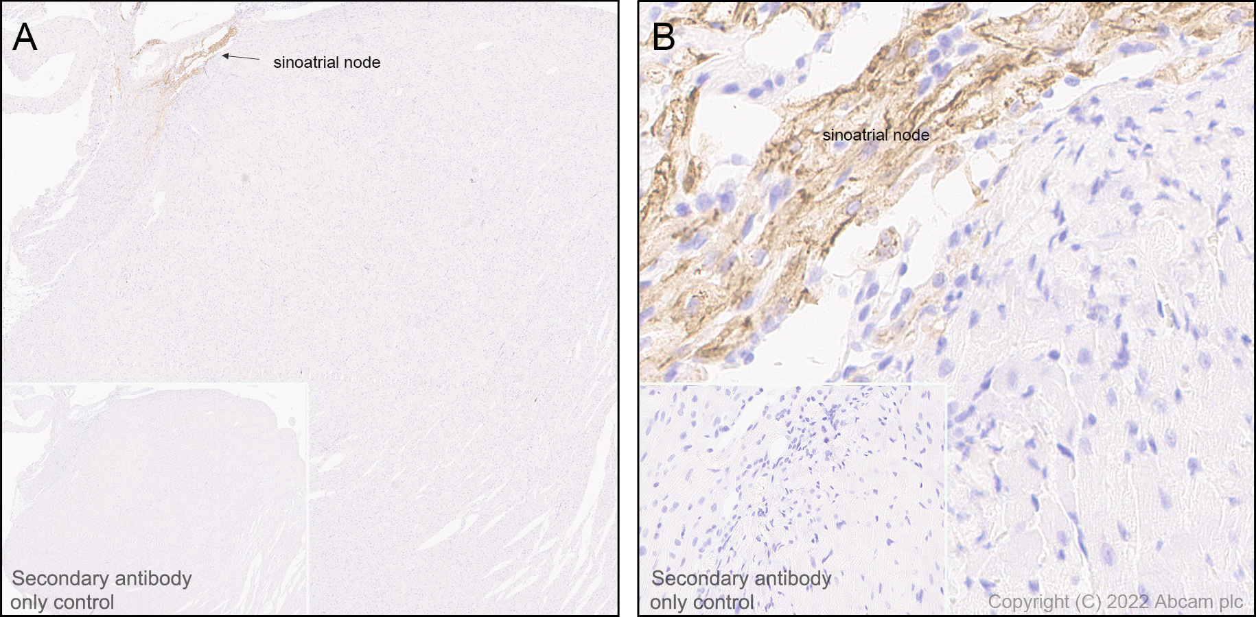 Immunohistochemistry (Formalin/PFA-fixed paraffin-embedded sections) - Anti-HCN4 antibody [EPR25291-44] - BSA and Azide free (AB289985), expandable thumbnail